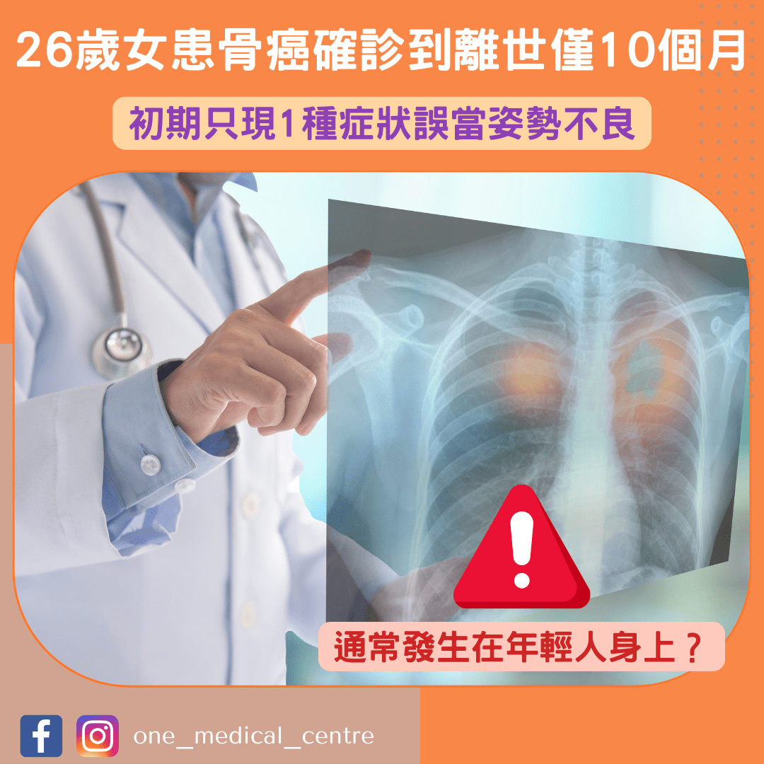 【26歲女患骨癌確診到離世僅10個月　初期只現1種症狀誤當姿勢不良】